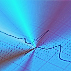 Ecg graph, electrocardiogram background