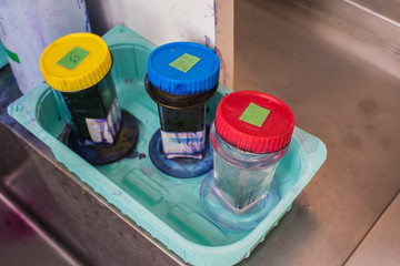 Wright stain for blood test in laboratory