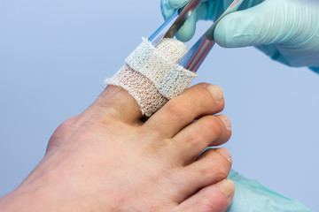 Fußpflege / Podologische Komplexbehandlung