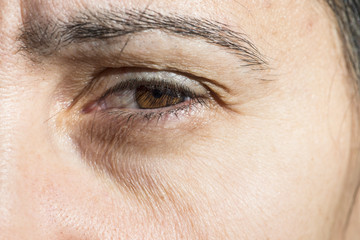 Fototapeta na wymiar Wrinkles under the eyes