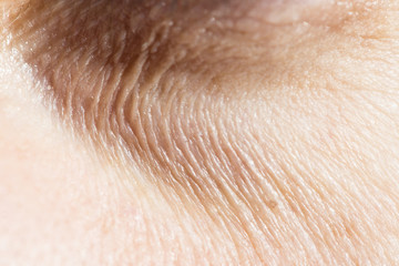 Fototapeta premium Wrinkles under the eyes