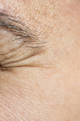 Fototapeta premium Wrinkles under the eyes
