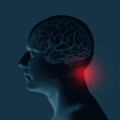 Obraz premium Healthcare and migraine concept - vector illustration