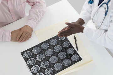 female doctor looking at patient x-ray picture of brain . above view