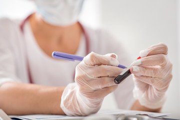 Female researcher making notes on blood sample