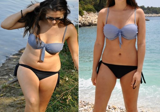 Real before and after weight loss photo of woman body in bikini
