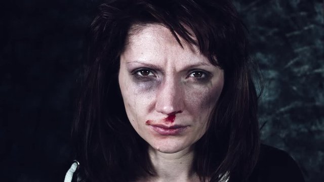 4k Domestic Violence and Abuse, Woman with Bruises Looking at Camera