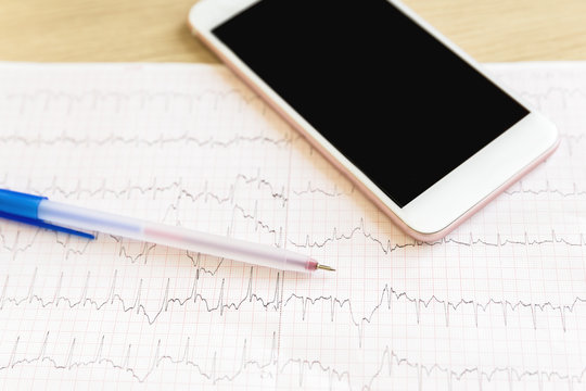 Pen on cardiogram grid paper
