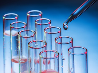 Different laboratory beakers and glassware.