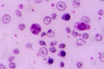 nucleated red cell