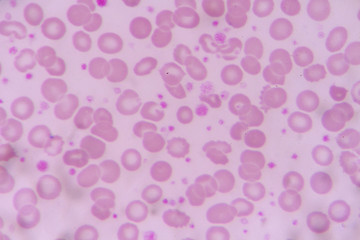 complete blood count