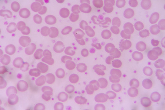 complete blood count