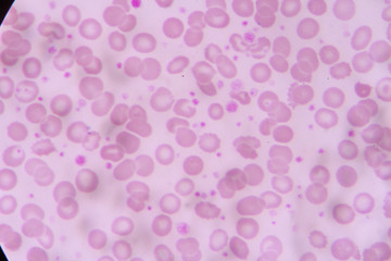 complete blood count