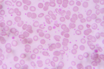 complete blood count