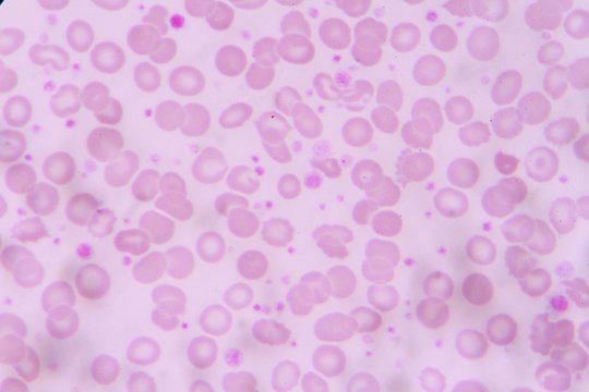 complete blood count