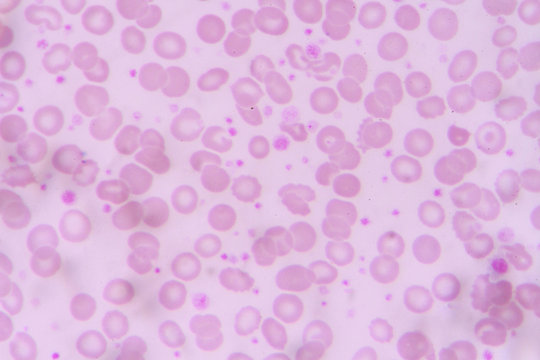 complete blood count