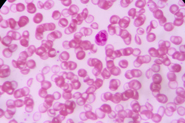 complete blood count