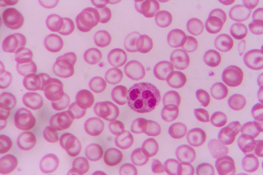 complete blood count