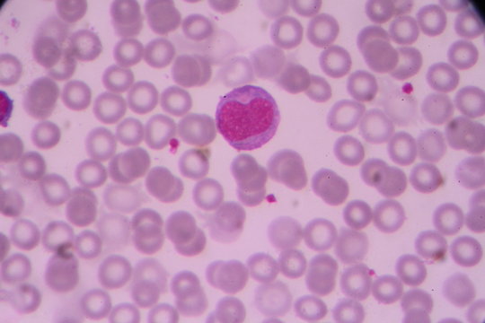 slide blood smear show white blood cell for complete blood count