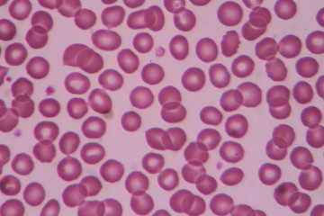 Normal red blood cells.