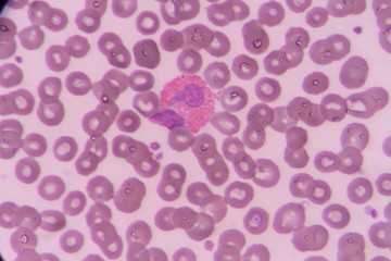  blood smear show Eosinophil for complete blood count