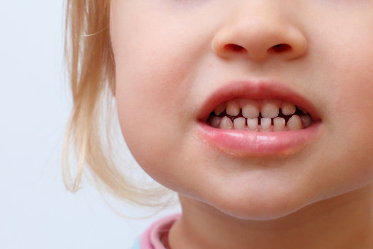 the girl's smile with the baby teeth closeup