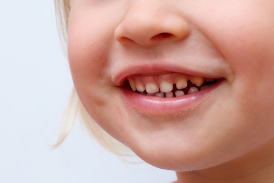 the girl's smile with the baby teeth closeup