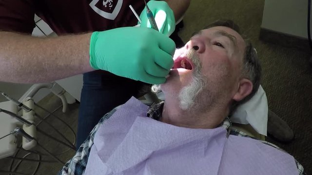 Dentist examing teeth male patient. Dental caries or tooth decay, cavities a breakdown of teeth due to activities of bacteria.