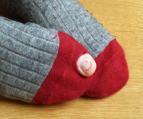 sock with a hole and a smiley painted on the toenail