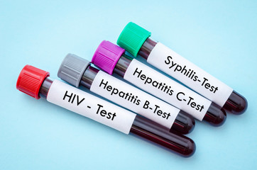 Obraz premium IV, HCV, HBV and shyphilis.