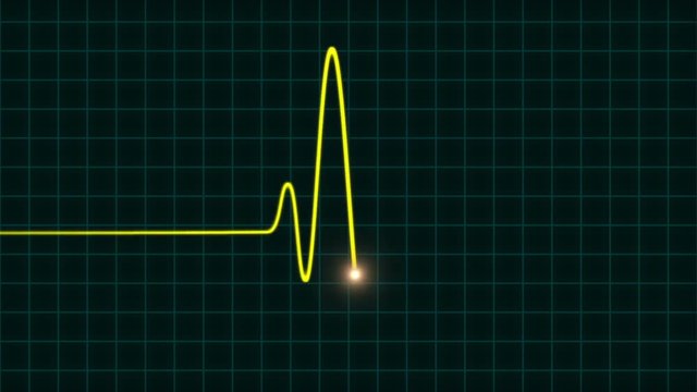 An Animated EKG Heartbeat Monitor In Yellow Wave Line (one Beat)