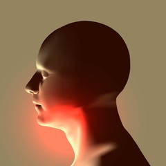 Laryngitis vector illustration. Human throat irritation. - 127561327