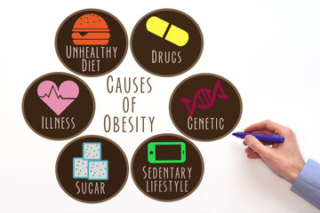 Causes of obesity 