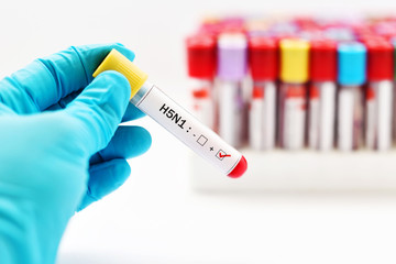 Fototapeta premium H5N1 influenza virus positive