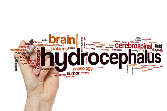 Hydrocephalus word cloud concept