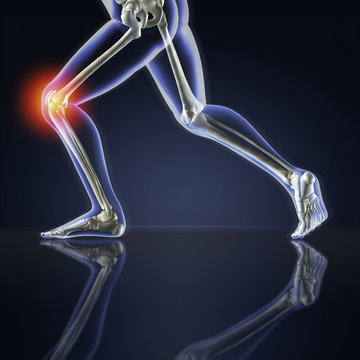 X-ray Runner with Knee Pain