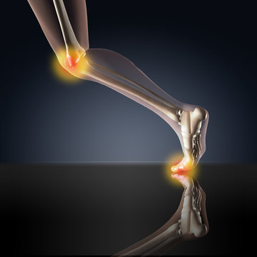 X-ray View of Knee and Ankle Pain