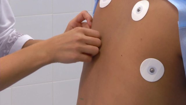 Holter monitor during surgery