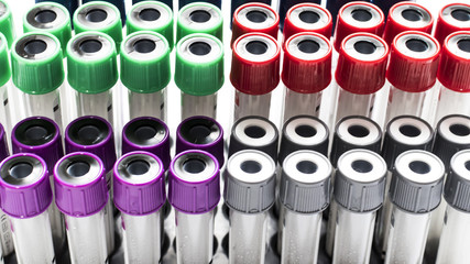 Colorful laboratory  tube.