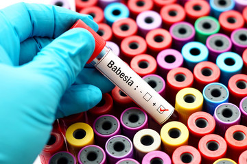 Fototapeta premium Babesia positive 