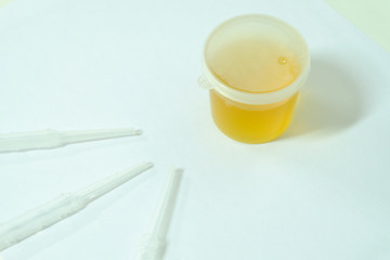 Urine sample for laboratory analysis