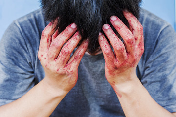 Fototapeta premium Bloody theme lone murderer: the murderer shows bloody hands and