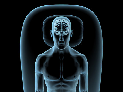 Blue Man Reclining with X-ray Brain