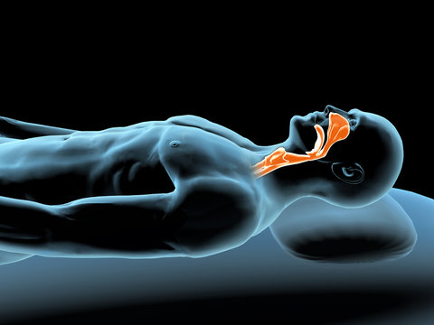 Sleeping Man with X-ray Sore Throat