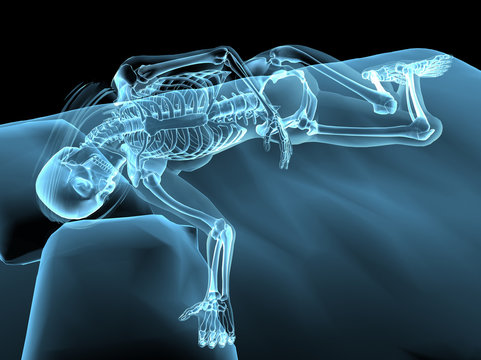 Blue X-ray Nude Sleeping Woman and Skeleton