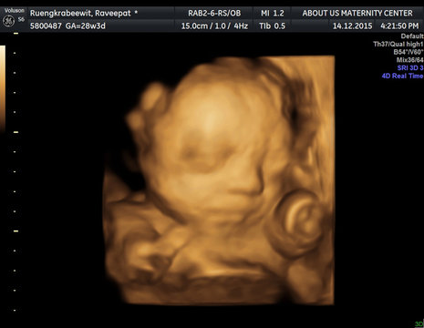 digital tablet with ultrasound scan of baby on screen,