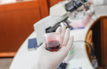 Urine sample for laboratory analysis