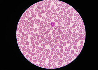 Normal red blood cells Under the microscope