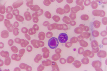 Atypical lymphocyte