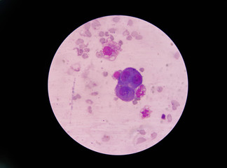mesothelial cell